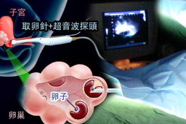 上海国际和平妇幼保健院试管婴儿费用是多少,上海试管婴儿双胞胎的价格是多