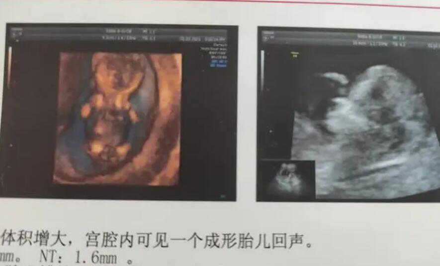 上海代怀最新价格表 上海试管婴儿技术如何 ‘b超如何看的儿子和女儿’