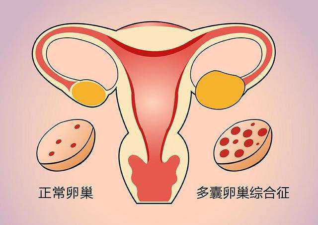 上海哪家代生生宝宝 上海第三代试管技术有哪些优势? ‘男孕囊和女孕囊的区别