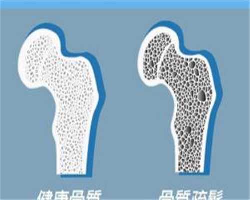 子宫粘连不孕